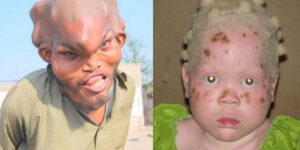 inbreeding